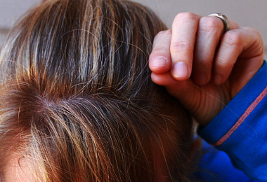 Стресс и волосы: учёные выяснили причину возникновения ранней седины